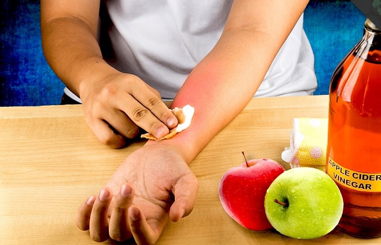 How to Get Rid of Poison Ivy The Basic Guide Everyone Needs to Know