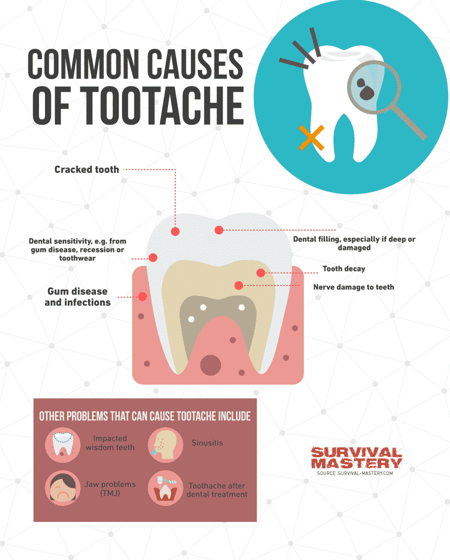 Toothache infographic