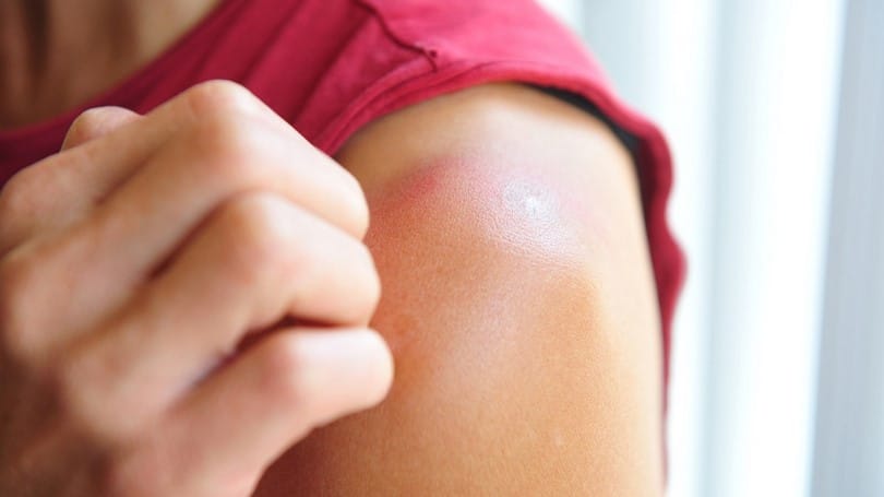 Avoid scratching and sun exsposure