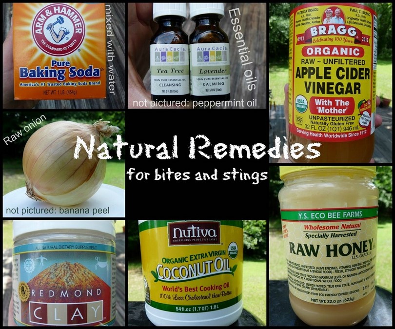 Home remedies for bites and stings