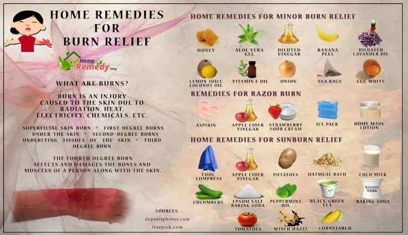 Home remedies for sunburns