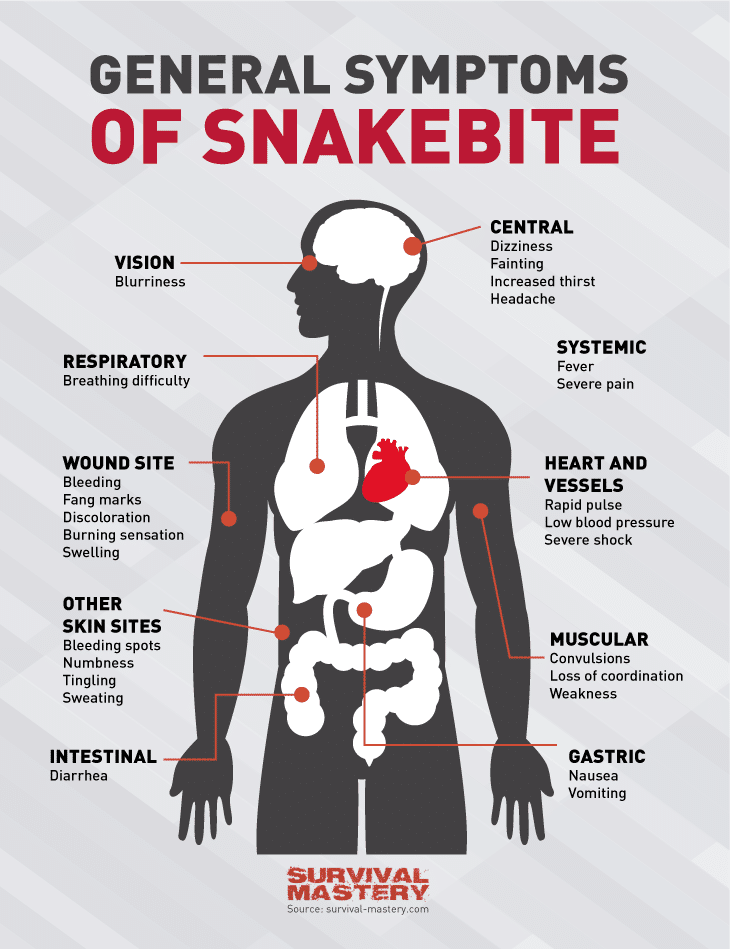 Snake bite infographic