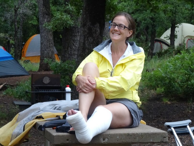 Camping Fractures and sprains