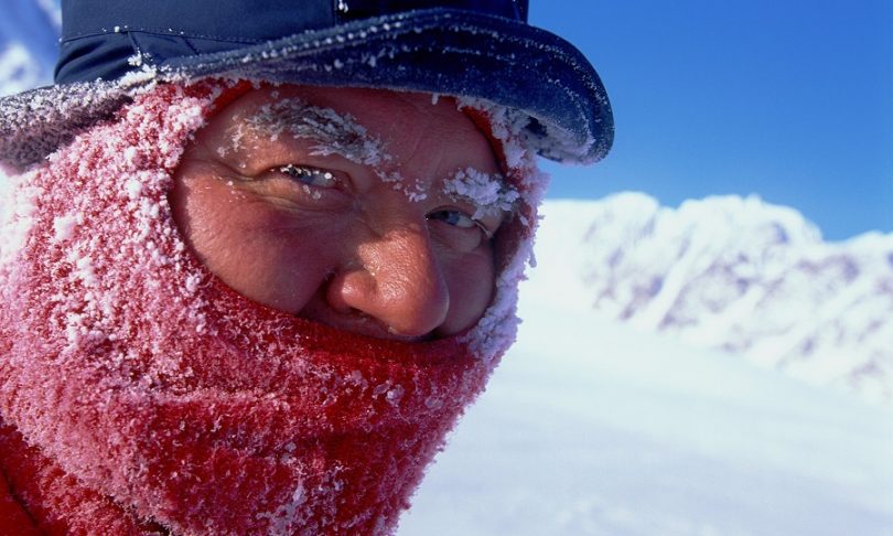 Camping Frostbites on a man